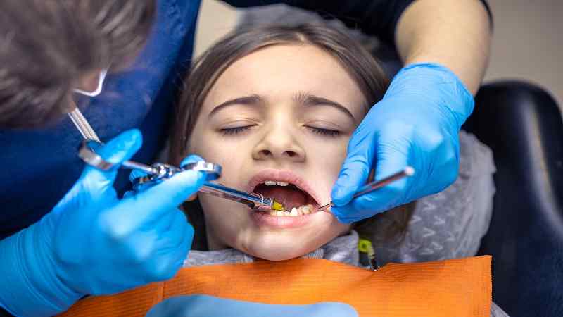 Sealants and Fluoride: The Two-Step Defence Against Childhood Cavities