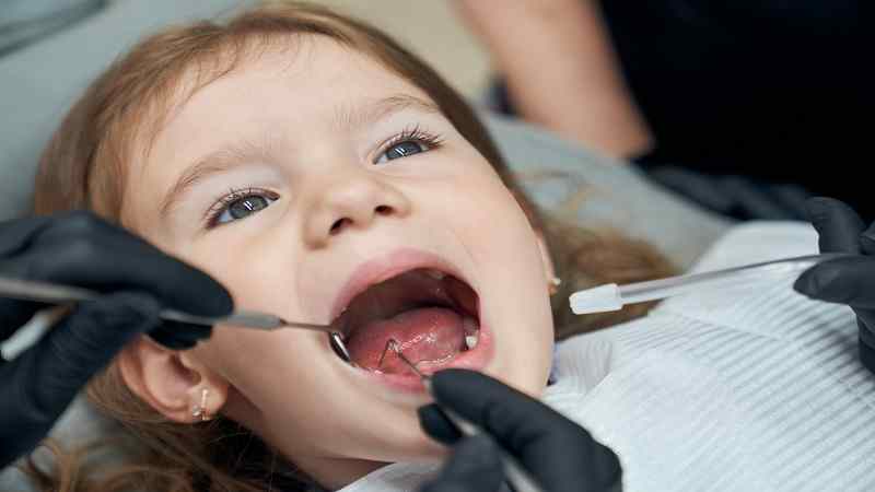 Recognizing Early Signs of Teeth Crowding in Young Children