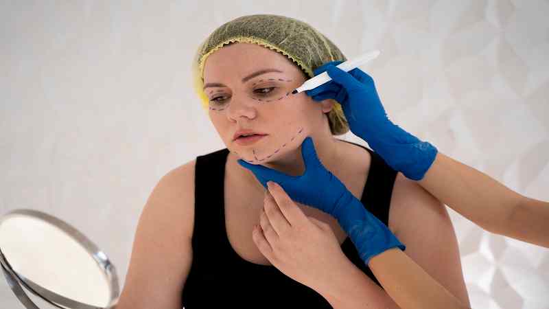 Restylane Defyne in Facial Rejuvenation: When Structure and Flexibility Both Matter